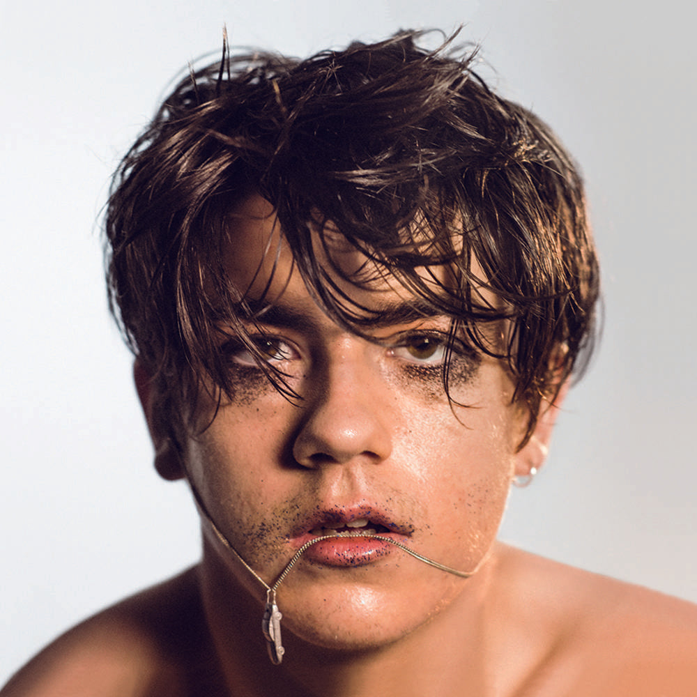 Declan McKenna - What Do You Think About The Car? [Translucent Yellow LP] Vinyl Record